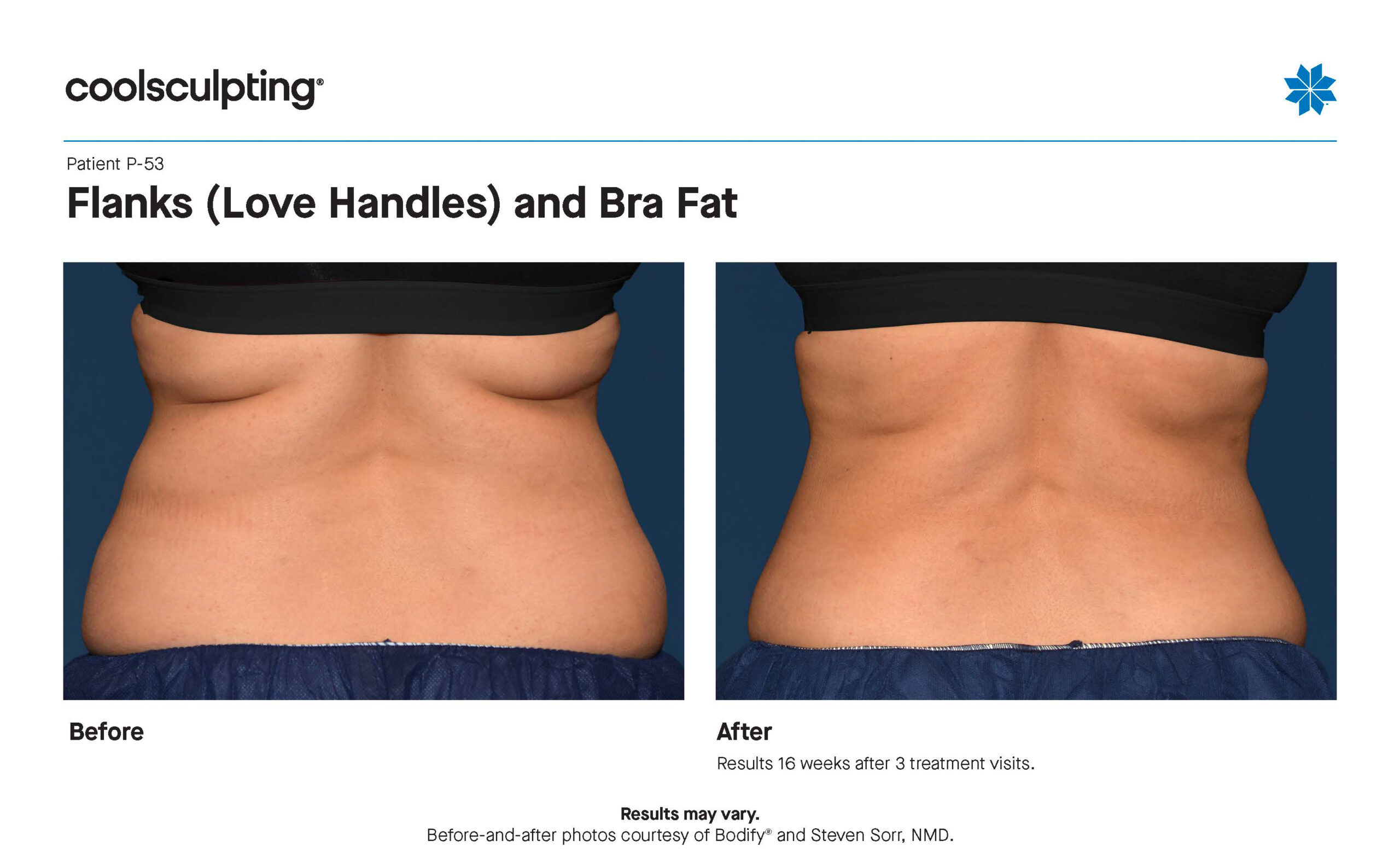 P-53 Flanks Bra Fat_Bodify-2